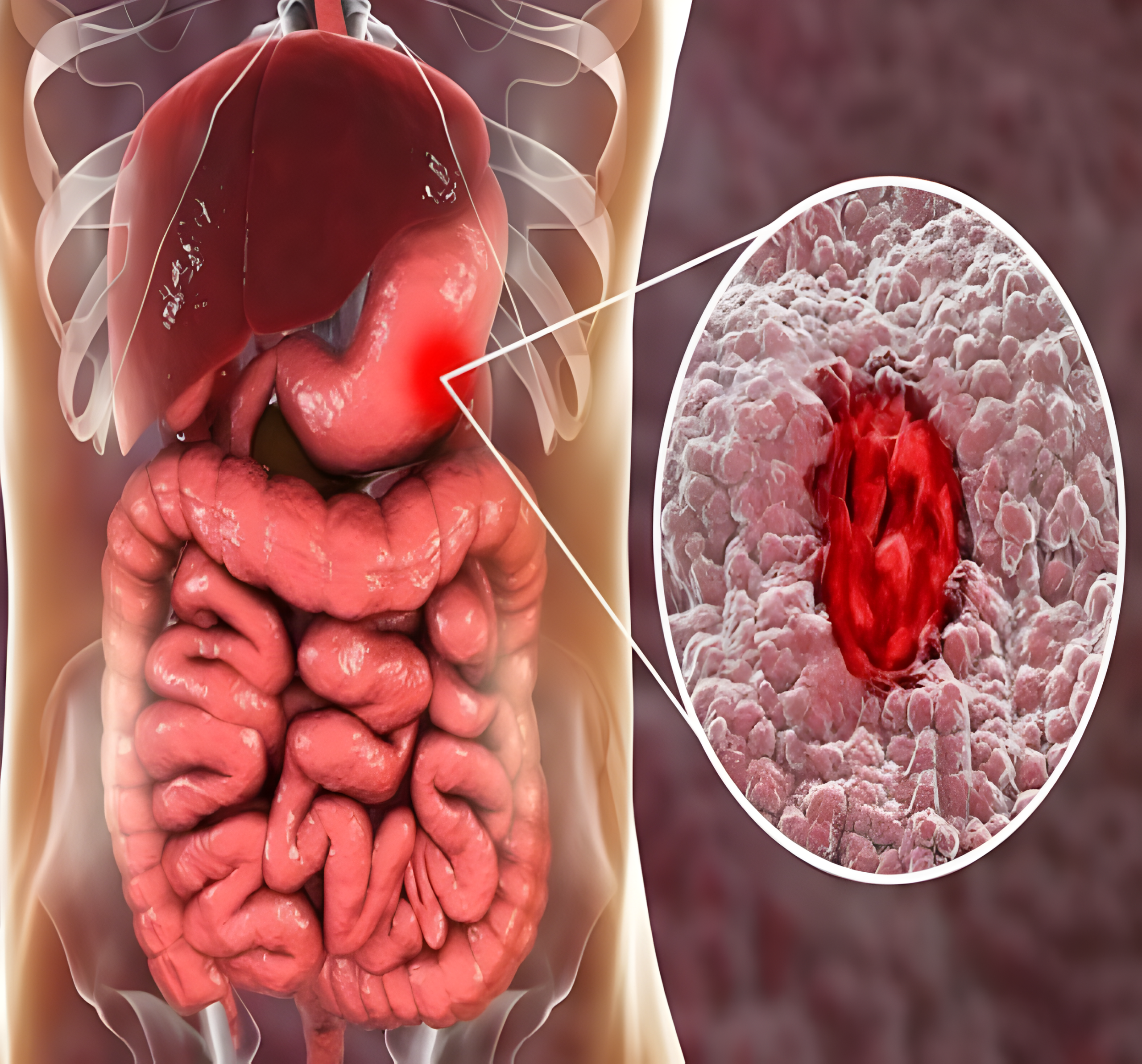 Ăn phải canh hoặc súp có chưa gói hút ẩm có nguy hiểm không?